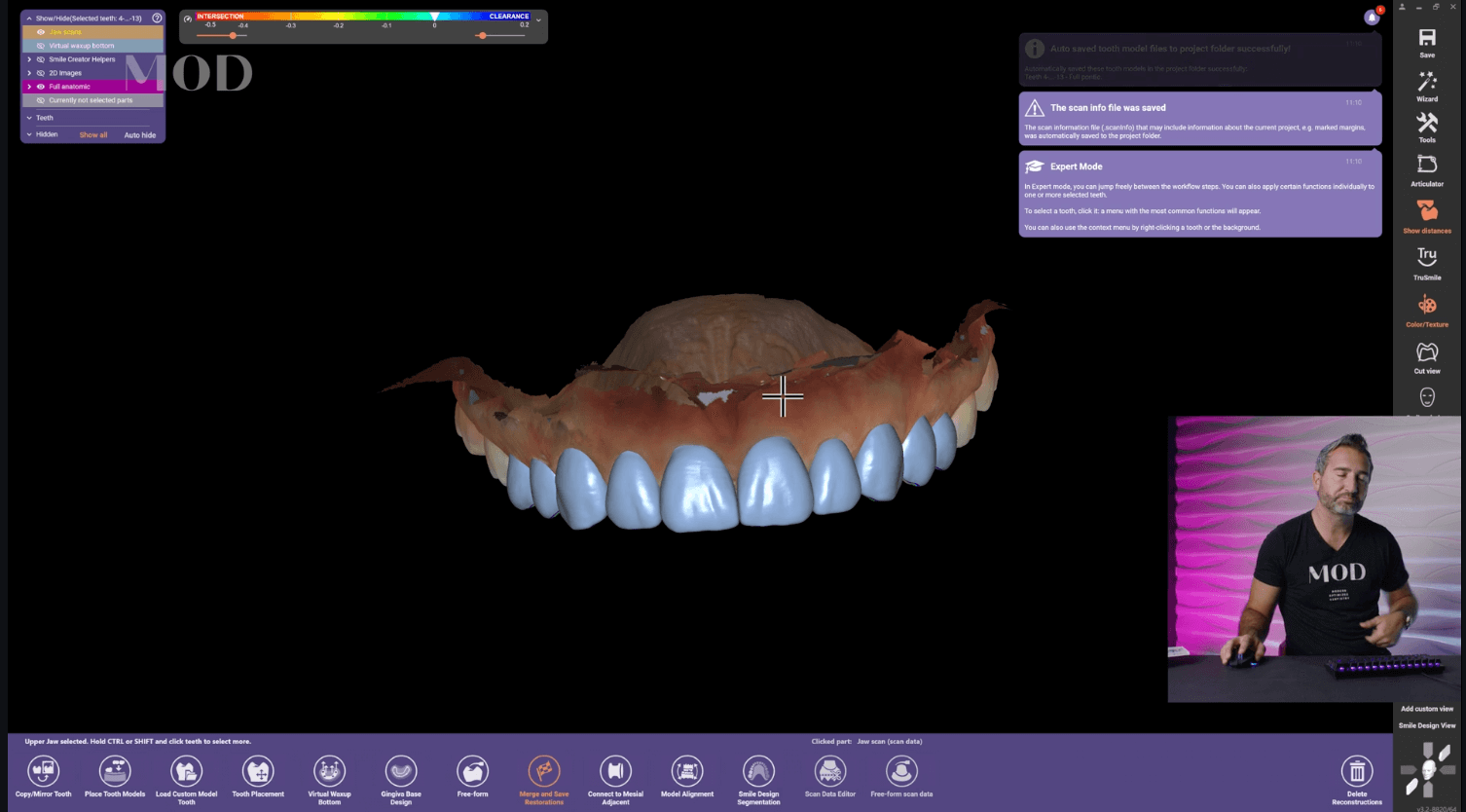 exocad Level 2 - Smile Design & Veneers