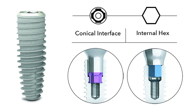 Implant Solutions