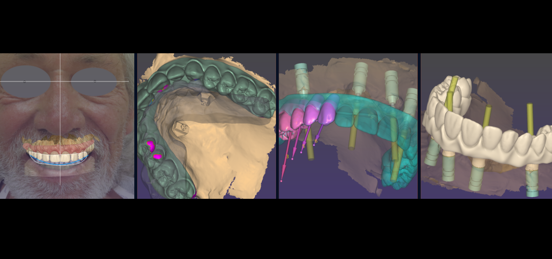 Photogrammetry Workflows